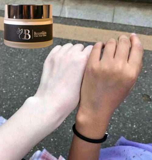 Whitening Cream for Radiant Skin - 1 PCS whitening & Brightening Solutions